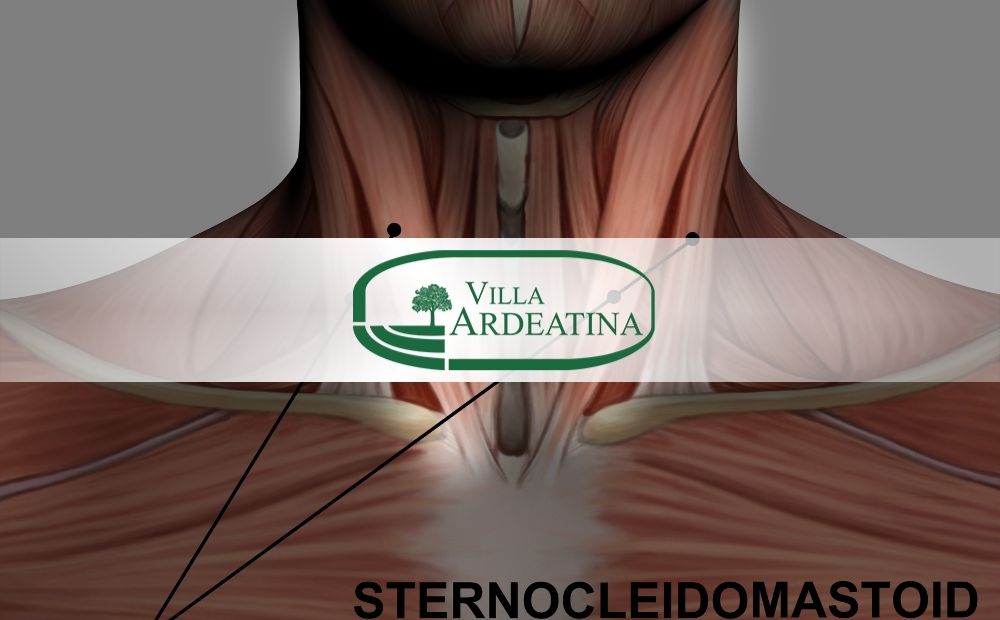 sternocleidomastoideo cause e cure